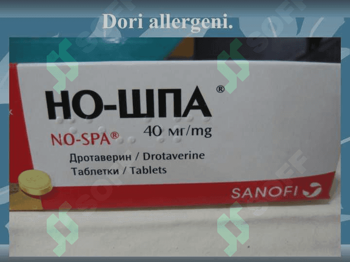 O’tkir allergozlar slayd ppt pptx 8