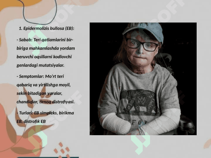 Terining (dermatozlar) nasliy kasalliklari 3