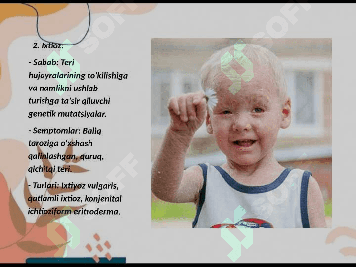 Terining (dermatozlar) nasliy kasalliklari 4