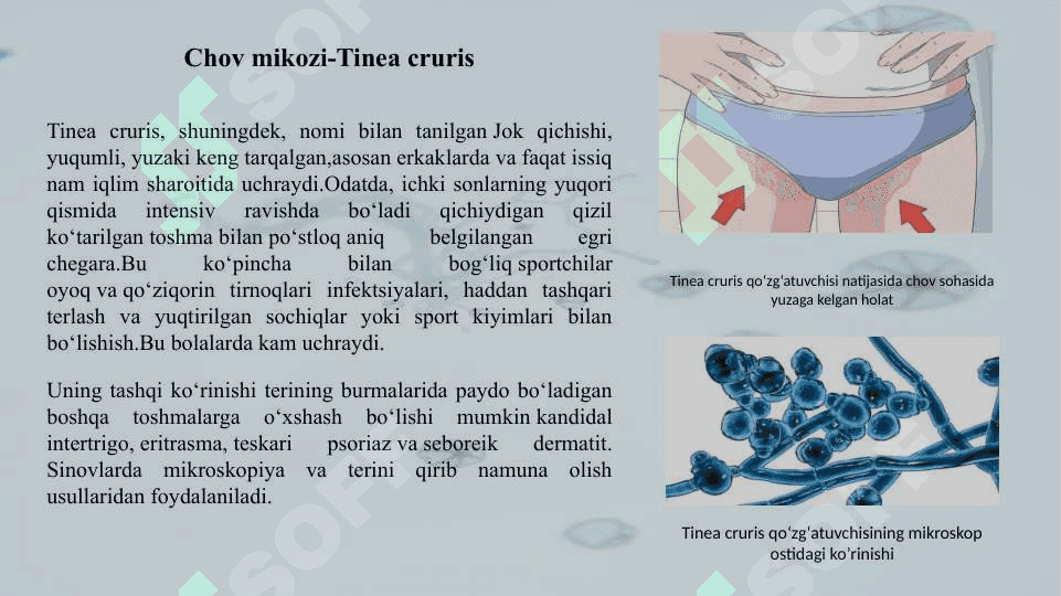 Zamburugʼli kasalliklar, patogenezi va laboratoriya tashhisi 8