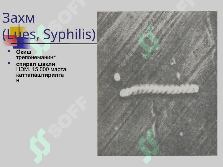 ЗАХМ (СИФИЛИС) Захм (Lues, Syphilis) 4