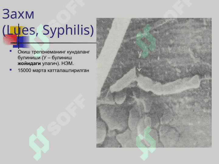 ЗАХМ (СИФИЛИС) Захм (Lues, Syphilis) 7