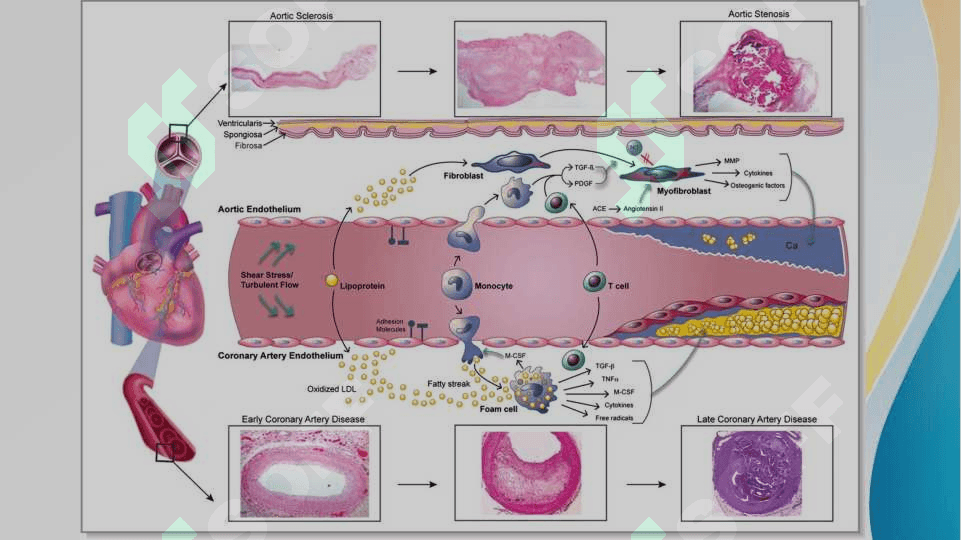Arterial qon tomirlarni surunkali obliteratsiyasida zamonaviy davolash usullari 7