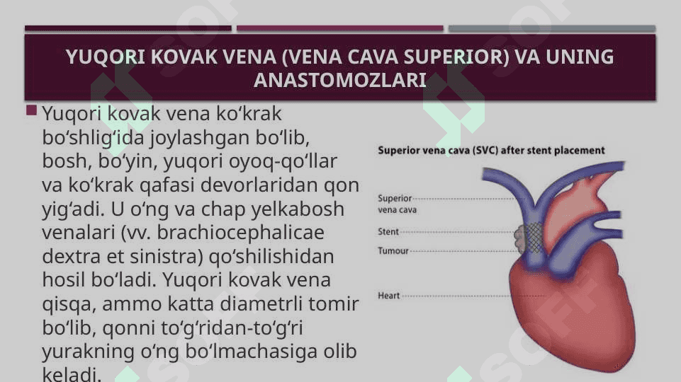 Kovak vena anastomozlari 5