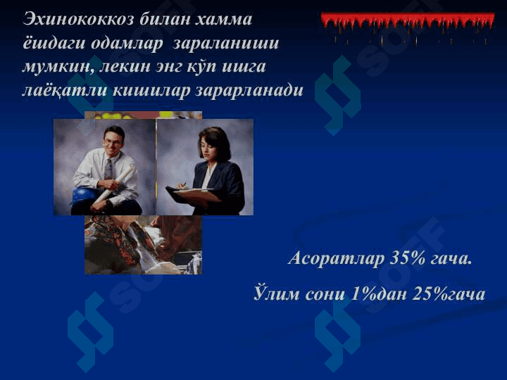Bolalarda Exinokokk kasalligi. Etiopatogenez, klinika, diagnostika va davolash usullari. 4