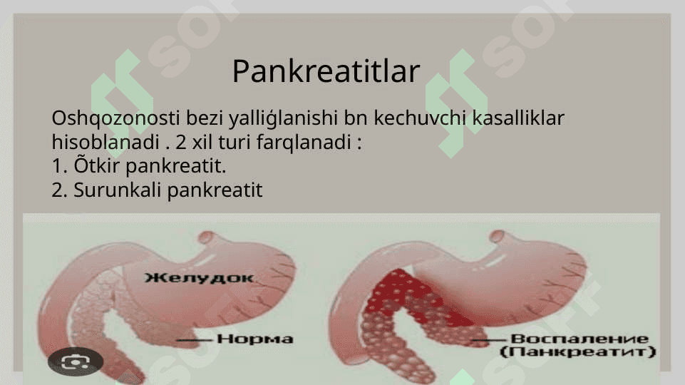 PANKREATIT 2