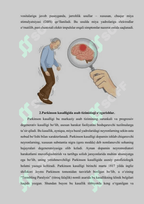 Parkinson kasalligi 4