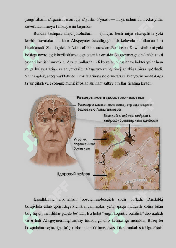 Alsgeymer kasalligi 4