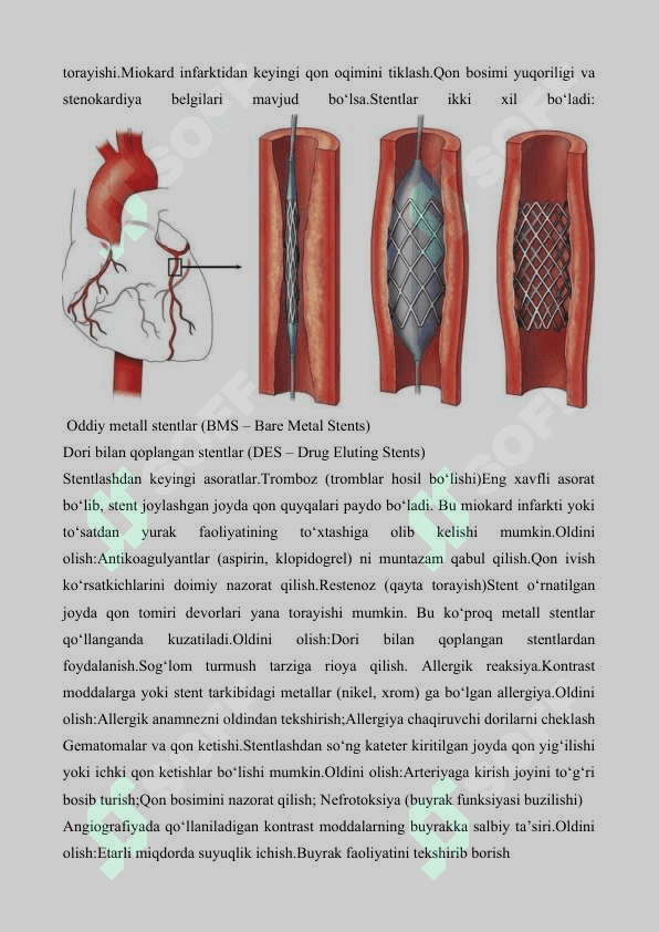 STENTLASH AMALIYOTIDAN KEYINGI ASORATLAR VA ULARNING OLDINI OLISH  tayyor maqola jurnalga chop etilmagan 3