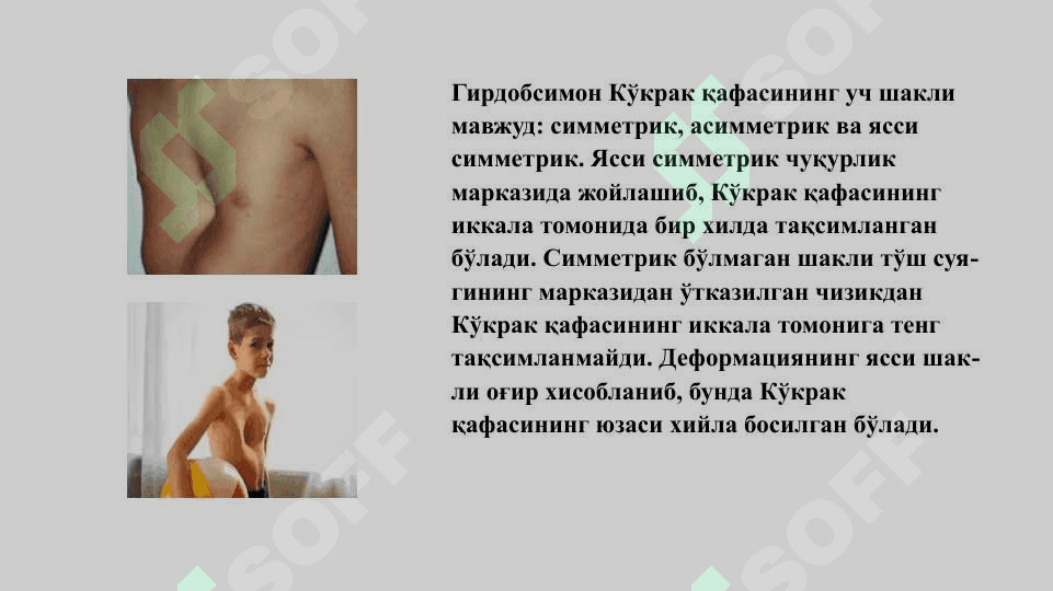 Кўкрак қафаси ва ўпканинг туғма ривожланиш нуқсонлари  ва аномалиялари  (лобар эмфизема, ўпка туғма кисталари, ўпка секвестрацияси, туғма брохоэктазлар) клиника, диагностика, даволаш, асоратлари, операциядан кейинги реабилитация 4