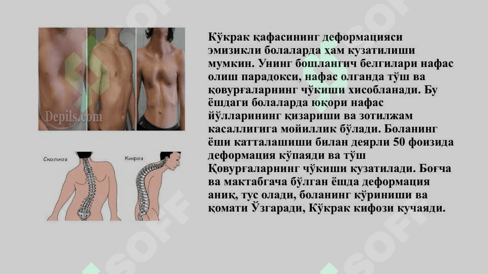 Кўкрак қафаси ва ўпканинг туғма ривожланиш нуқсонлари  ва аномалиялари  (лобар эмфизема, ўпка туғма кисталари, ўпка секвестрацияси, туғма брохоэктазлар) клиника, диагностика, даволаш, асоратлари, операциядан кейинги реабилитация 6