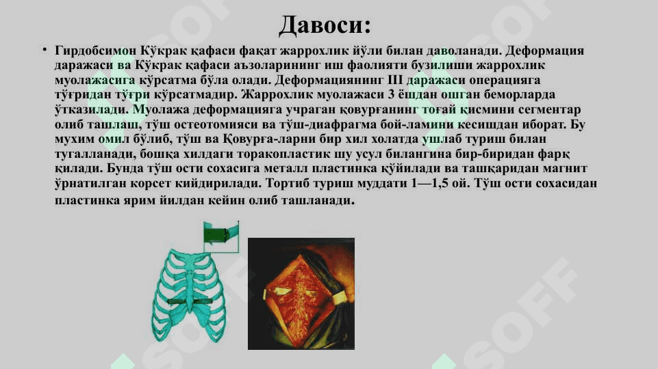 Кўкрак қафаси ва ўпканинг туғма ривожланиш нуқсонлари  ва аномалиялари  (лобар эмфизема, ўпка туғма кисталари, ўпка секвестрацияси, туғма брохоэктазлар) клиника, диагностика, даволаш, асоратлари, операциядан кейинги реабилитация 8