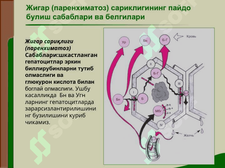 ЖИГАР КАСАЛЛИКЛАРИДАГИ АСОСИЙ КЛИНИК СИНДРОМЛАР 8