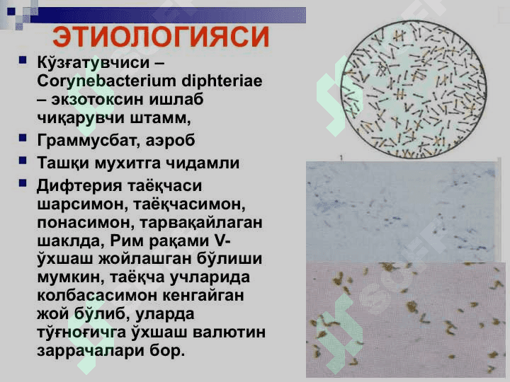 bo`g`ma difteriya pptx 4
