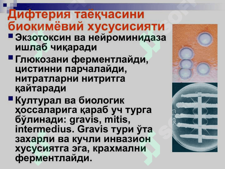 bo`g`ma difteriya pptx 5