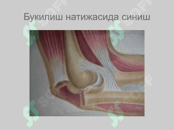 Suyaklarning sinishi va chiqishi diagnostikasi 5
