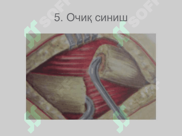 Suyaklarning sinishi va chiqishi diagnostikasi 7