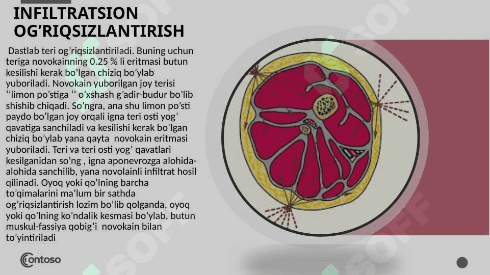 Zamonaviy og’riqsizlantirish usullari 4
