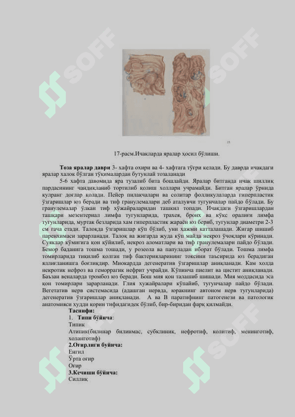 ҚОРИН ТИФИ. 3