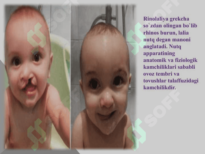 Rinolaliyada ovoz buzilishi va uni korreksiyalash. 4