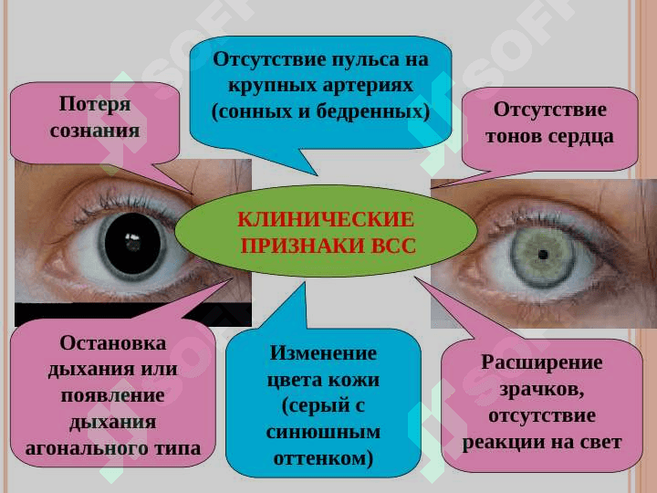 ВНЕЗАПНАЯ  СМЕРТЬ ПРИЧИНЫ ВНЕЗАПНОЙ СМЕРТИ 8