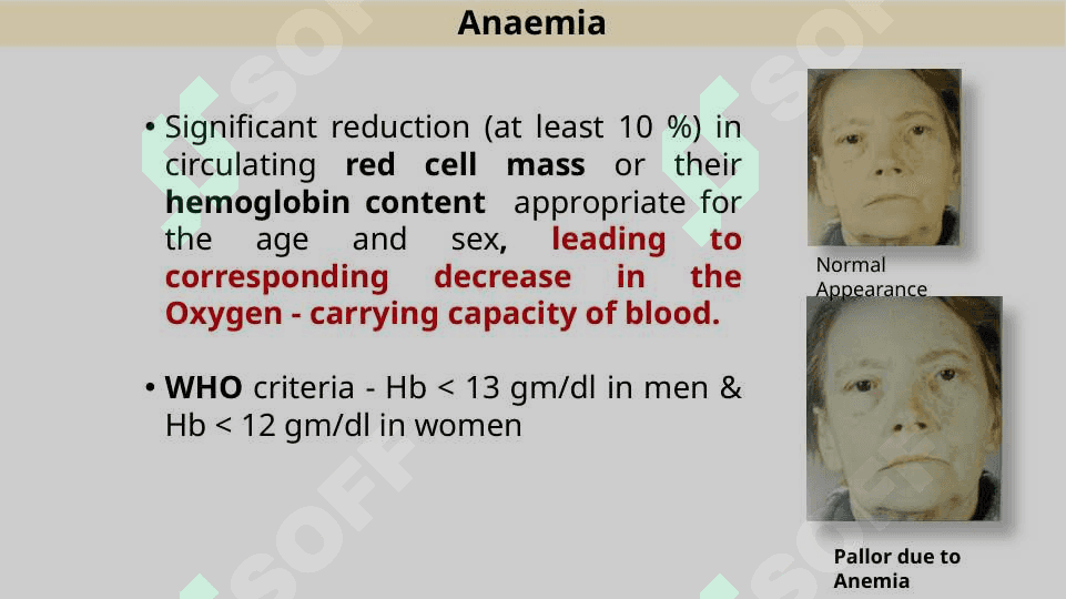 Hematology anemia 3