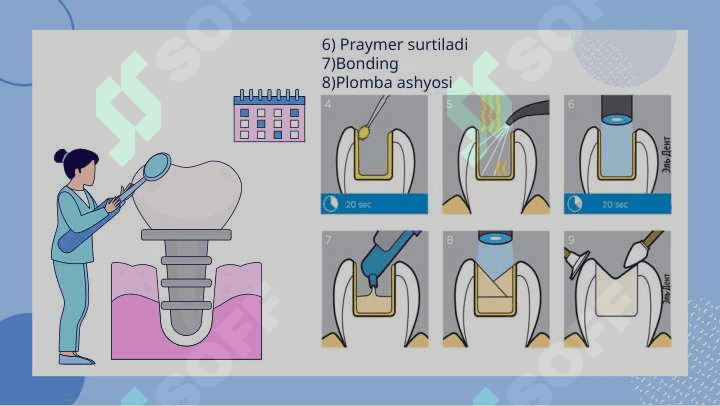 Universal adgeziv tizimlar. 8