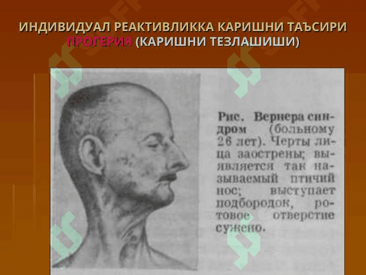Организм реактивлиги. Инсон патологиясида реактивликни роли 7