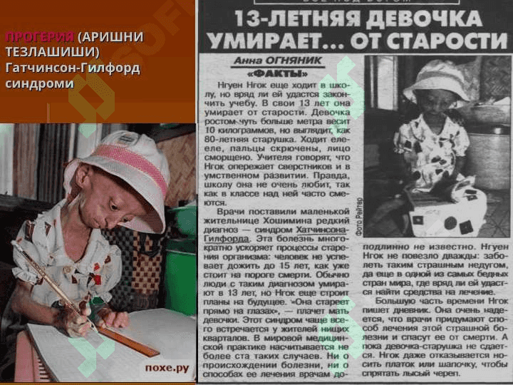 Организм реактивлиги. Инсон патологиясида реактивликни роли 8