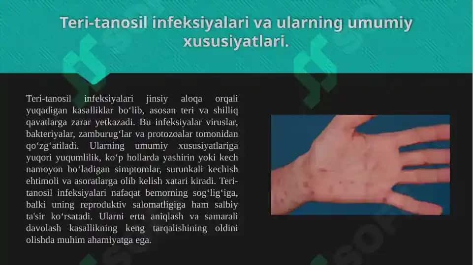 Teri-tanosil infeksiyalari qo'zg'atuvchilari va tashhisi 3