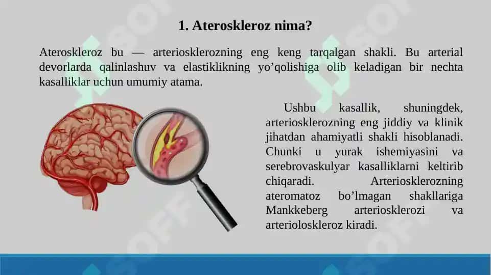 Aterosklerozning kelib chiqish mexanizmi. Taqdimot 16 bet. 2