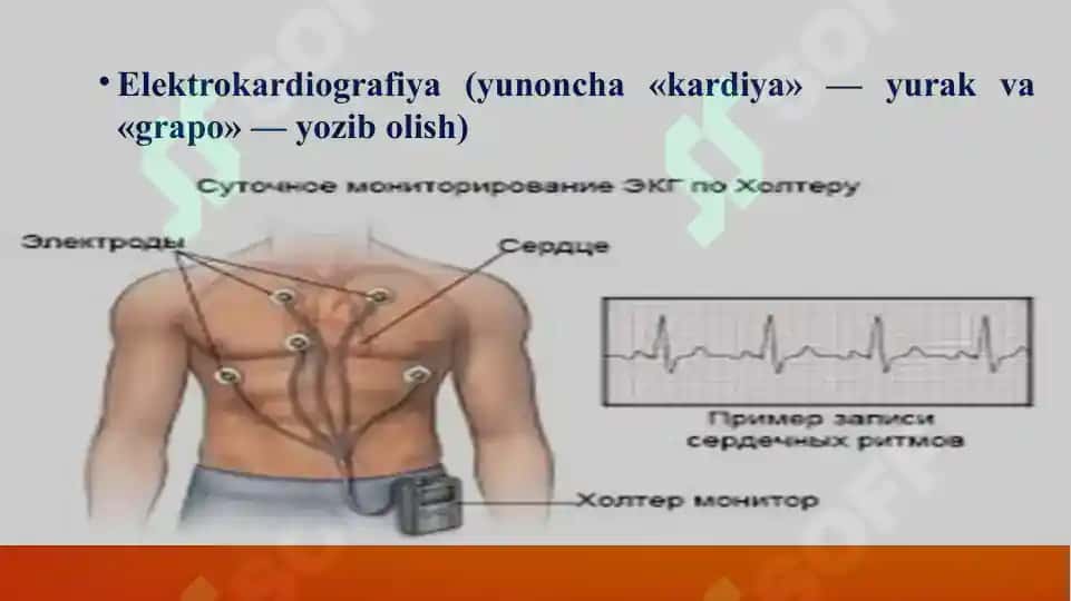 Elektrokardiografiya (EKG) 4
