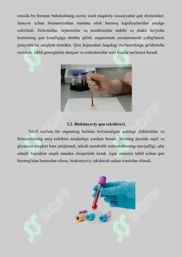 Klinik labaratoriyada ishlatiladigan instrumental usullar. Referat 18 bet. 7