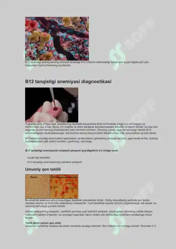 B12 yetishmovchiligi anemiyasi 4
