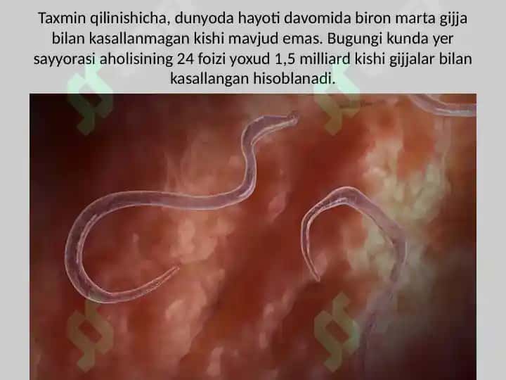 Odam gelmintoz kasalliklari 4