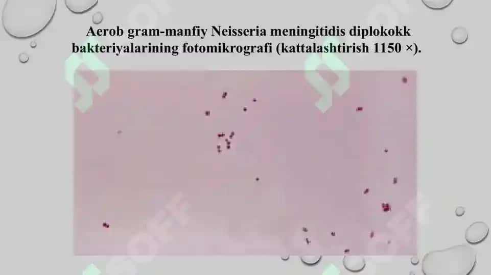 Yiringli yallig'lanish kasalliklarni keltirib chiqaruvchi mikroorganizmlar meningokokklar, pnevmokokklar keltirib chiqaradigan kasalliklarning laboratoriya tashxisi. Sifatli taqdimot 24 bet. 7