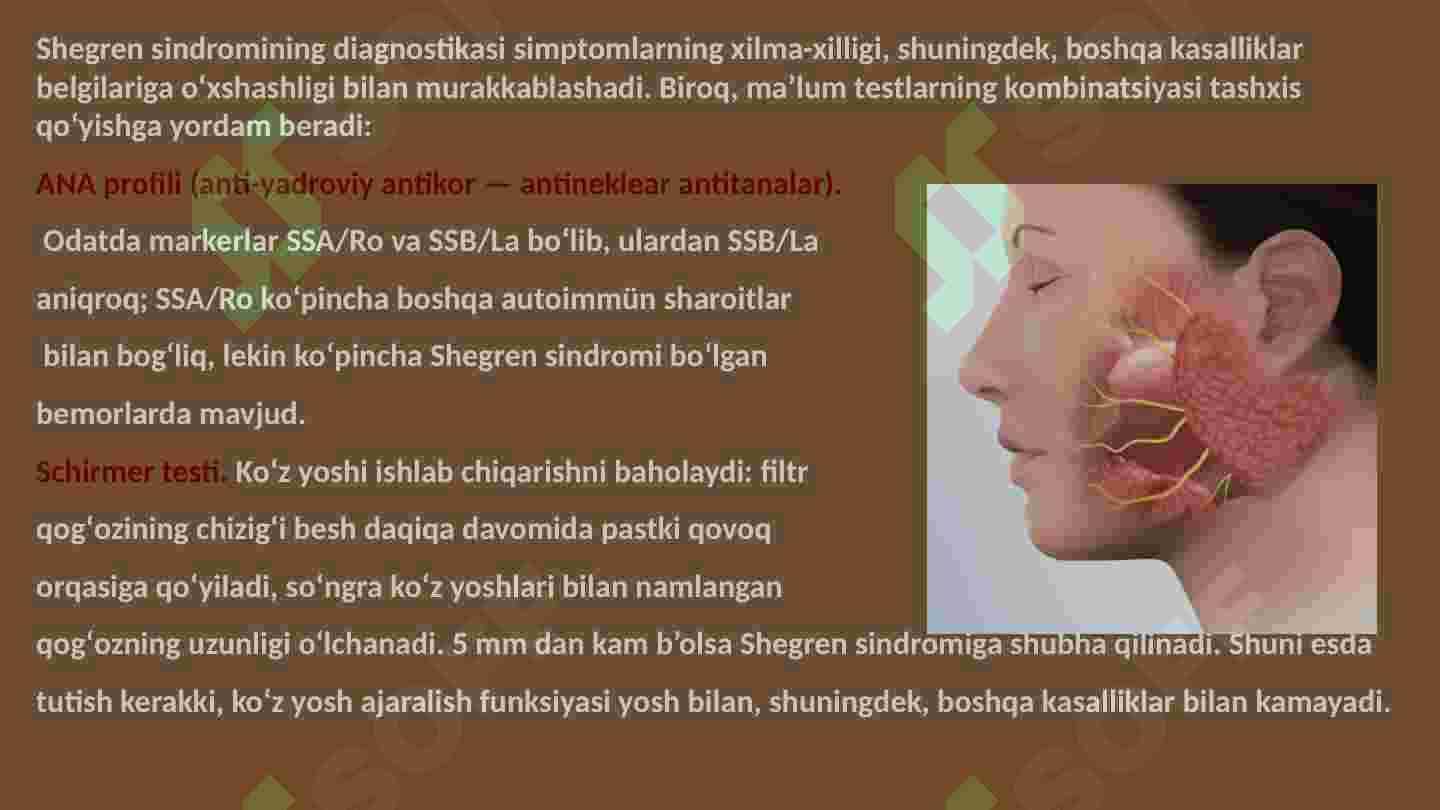 Shegren sindromi.Gastroezofelyar kasalligi 8
