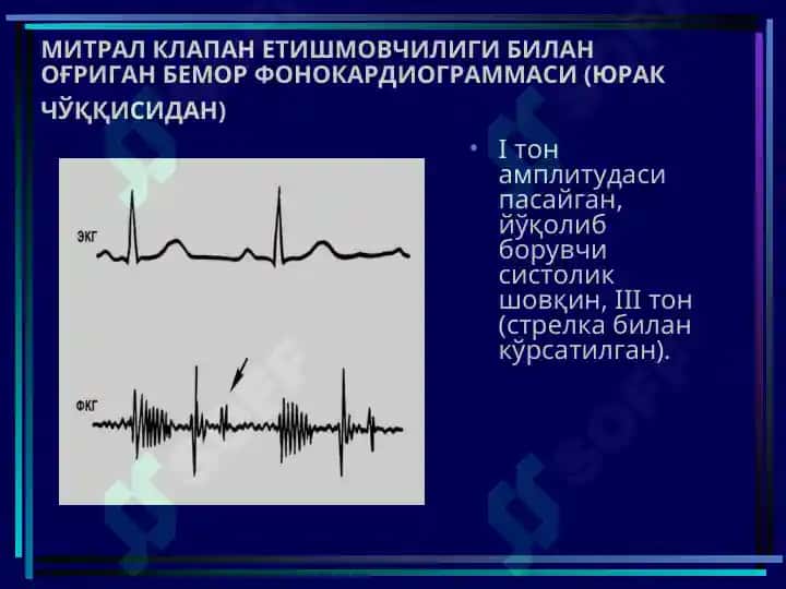ОРТИРИЛГАН ЮРАК НУҚСОНЛАРИ yurak kasaliklari 8