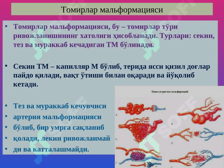 Qon tomirlar patologiyasi.Tomir anomaliyalari.Gipertenziya.Ateroskleroz.Anevrizmalar.YUIK 4