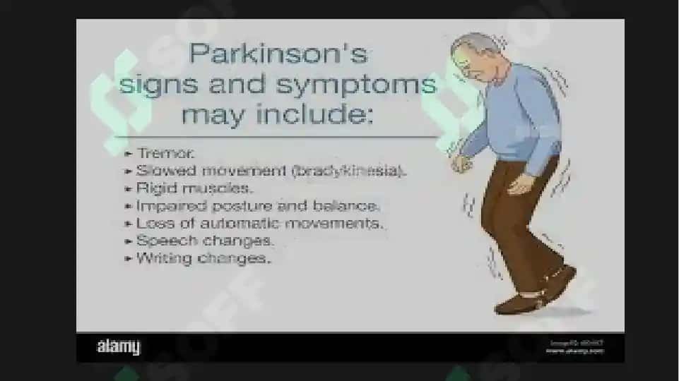 Parkinson kasalligini davolashda qo'llaniladigan dori vositalari 7