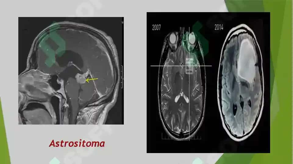 Tibbiyot radiologiyasi 5