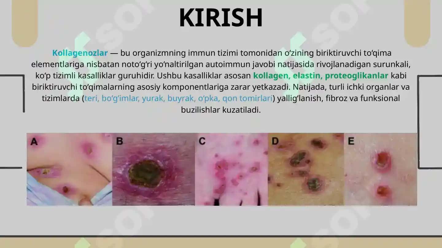 Kollagenozlar patogenezi va tashxisi 2