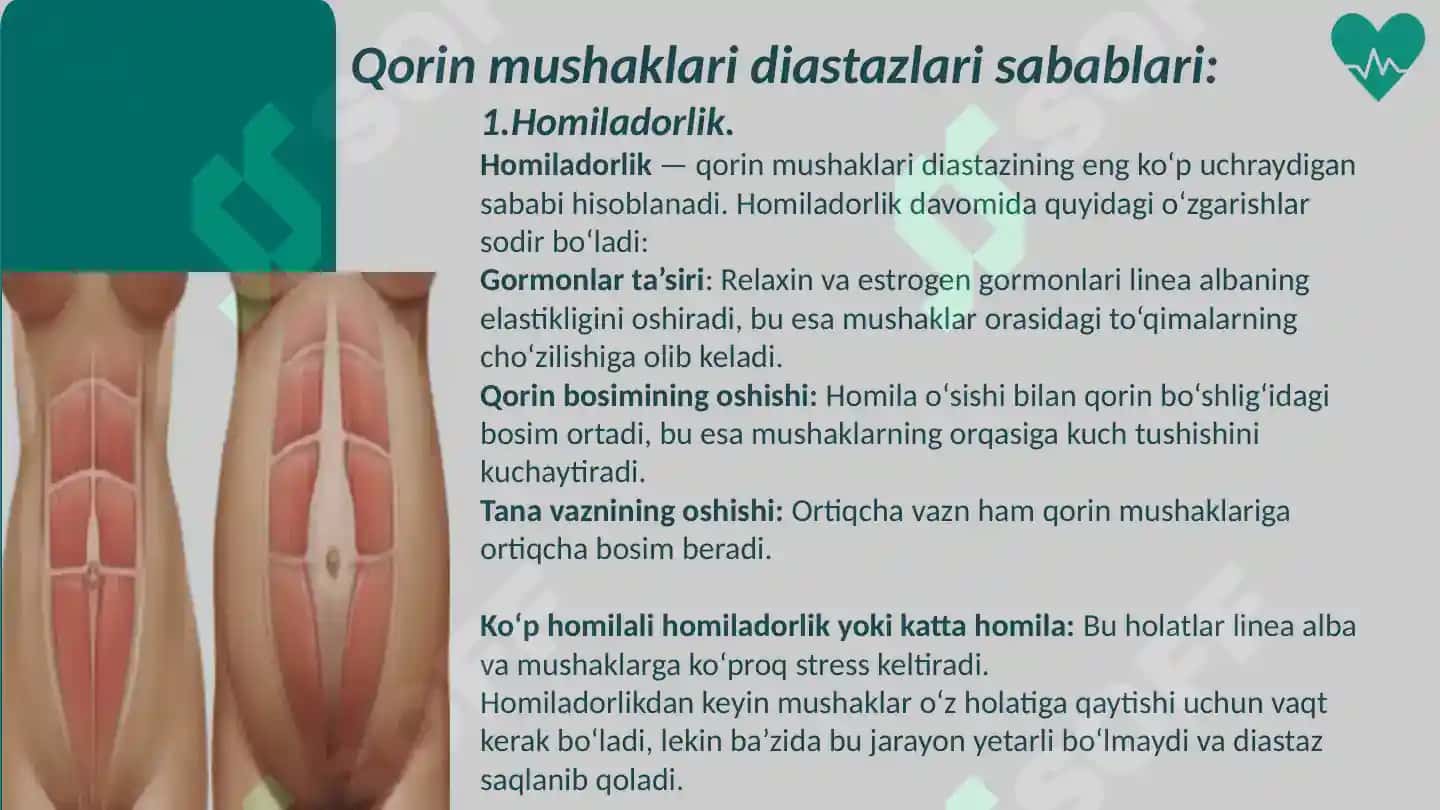 Qorin mushaklari  diastazlari 5