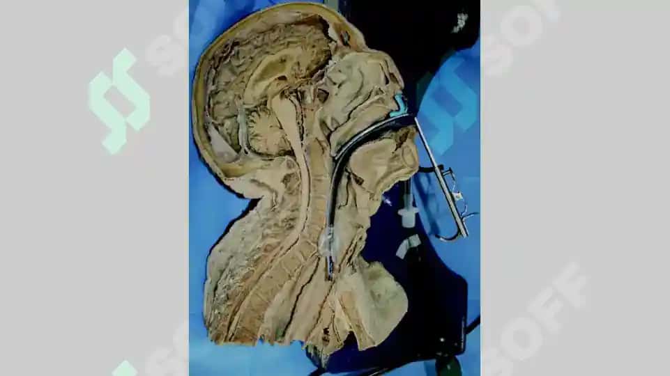 Pharynx 2