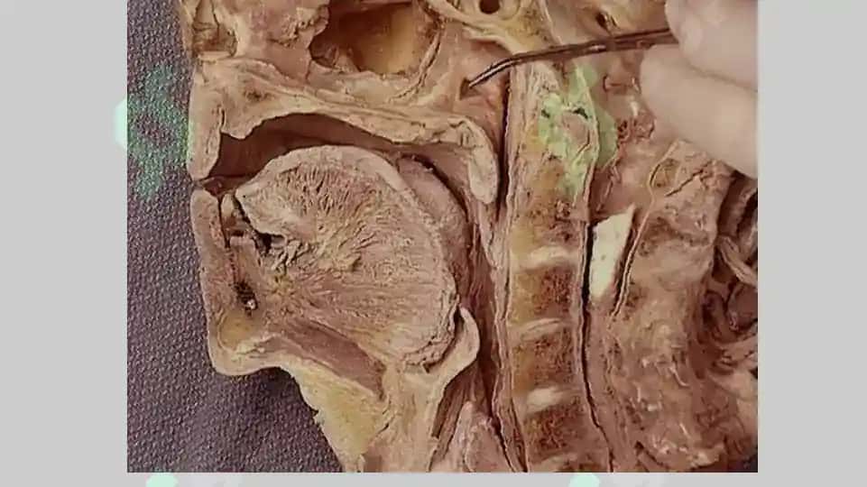 Pharynx 3
