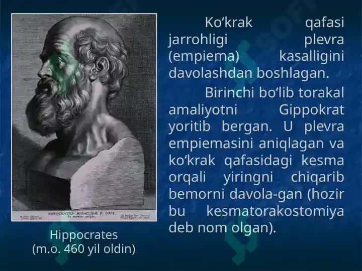 Plevra kasalliklari 3