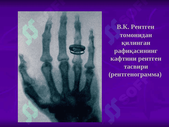 Ионлаштирувчи нур ташхисоти усуллари 8