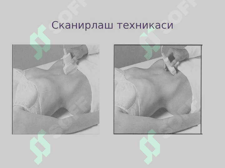 Репродуктив аъзоларнинг  ультратовуш ташхисоти 5