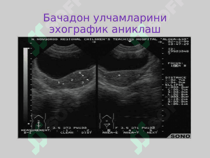 Репродуктив аъзоларнинг  ультратовуш ташхисоти 8