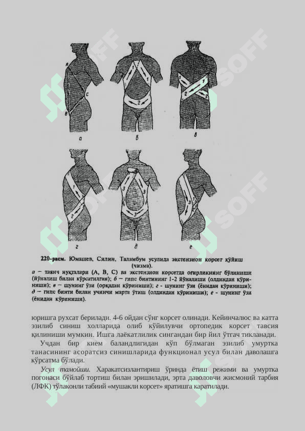 УМУРТҚА ПОҒОНАСИНИНГ АСОРАТСИЗ ШИКАСТЛАНИШЛАРИ 6